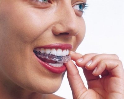 Invisalign – La revolución de la ortodoncia